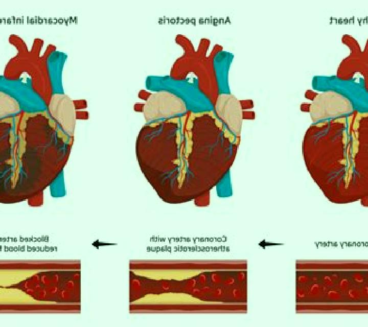 Provigil can provigil cause heart problems pharmacy