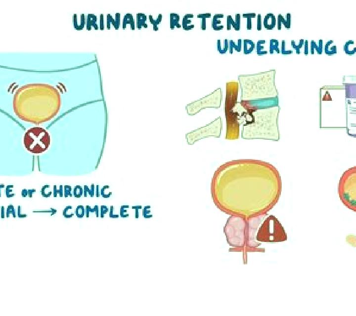 Provigil does provigil cause urinary retention tablet