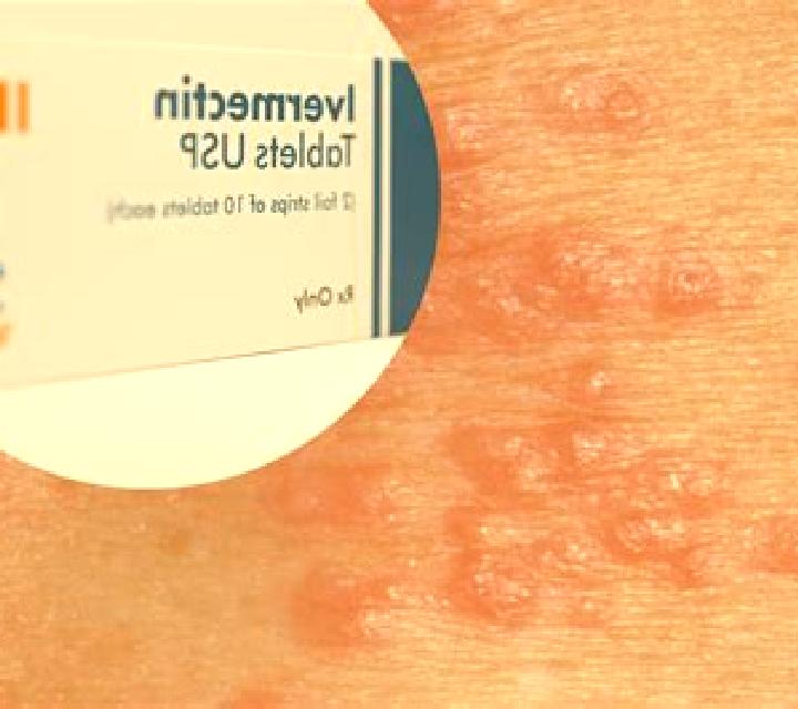 Stromectol stromectol scabies how does it work pills